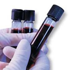 Αιματολογικές και βιοχημικές εξετάσεις