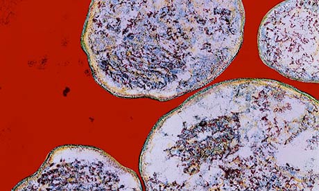 Chlamydia Trachomatis