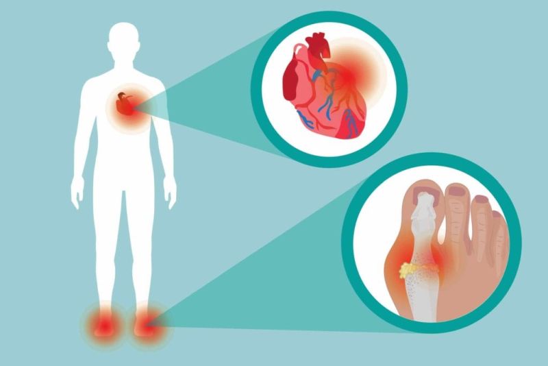 Φεβουξοστάτη και καρδιαγγειακός κίνδυνος