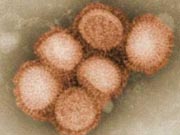 H1N1 Virus