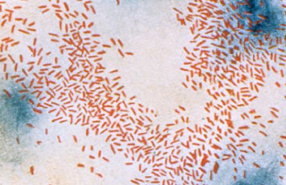 Άμεση κατά Gram χρώση του αιμόφιλου ινφλουέντζας τύπου b 