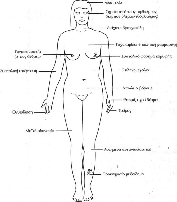 Συνοπτική περιγραφή συμπτωμάτων-σημείων υπερθυρεοειδισμού