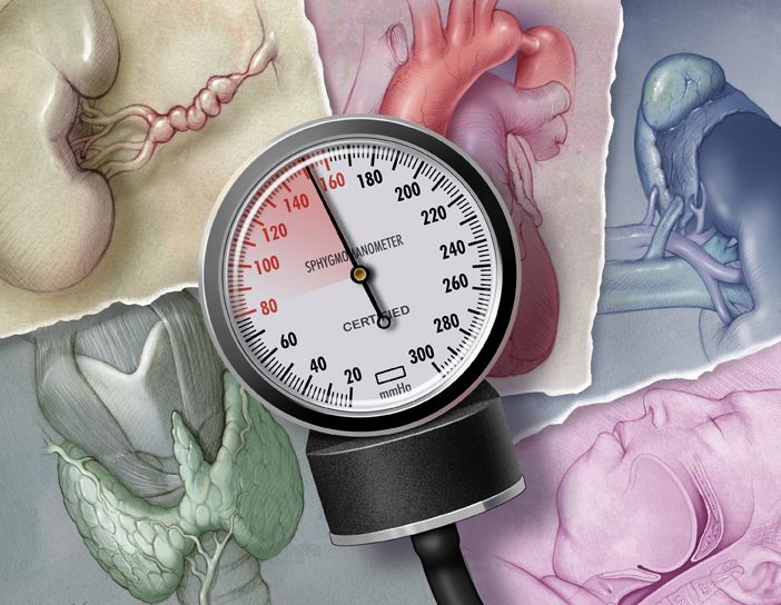 Δευτερογενής υπέρταση