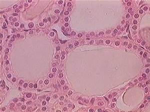 Ιστολογική εικόνα θυρεοειδούς