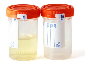 urine test